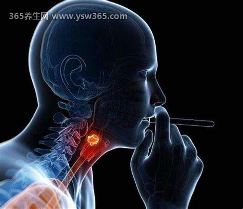 喉癌的早期症状和前兆,咳嗽痰中有血/有痛感/喉咙里有异物