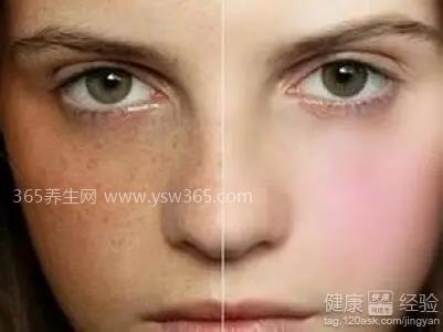 黄褐斑怎样才能彻底的去掉,注意防晒不要乱用化妆品可淡化
