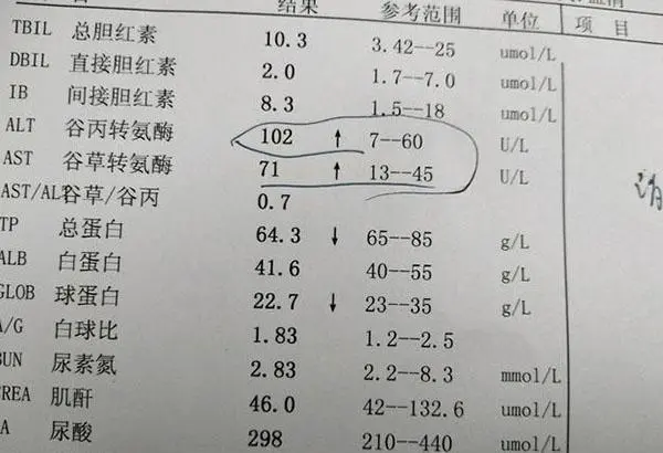 一般转氨酶多少就是肝炎了,超过0-40IU/L(及时就医)