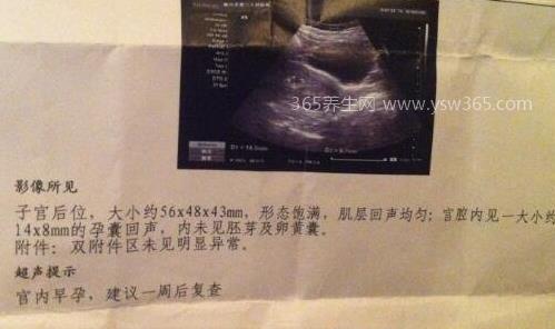 b超单有这个一般是女孩,看孕囊的形状是圆的有可能是女孩