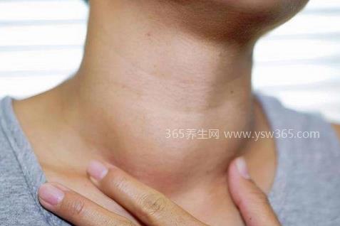为什么甲亢叫做不死的癌症,治疗周期长复发率高