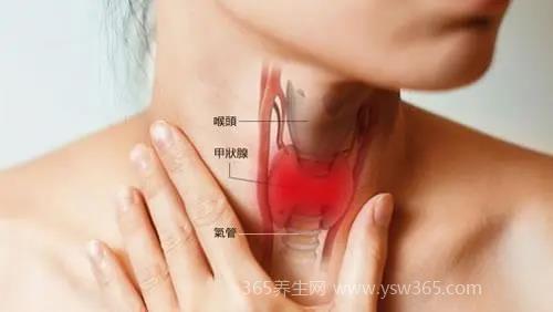 一张图自测是否有甲亢,怕热心慌失眠有可能是甲亢