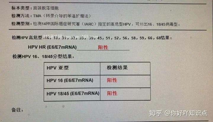 不要轻易做hpv和tct检查,会有15%-20%的漏诊率