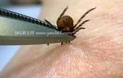 怎么判断自己身上有无蜱虫,身上感觉有疼痛或瘙痒可能就有