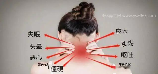 颈椎病早期的10大症状,落枕/颈椎疼痛/视物模糊均有可能
