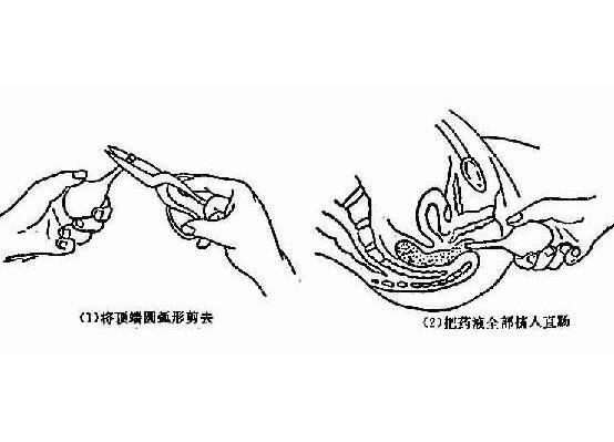 开塞露通便使用方法和姿势图片