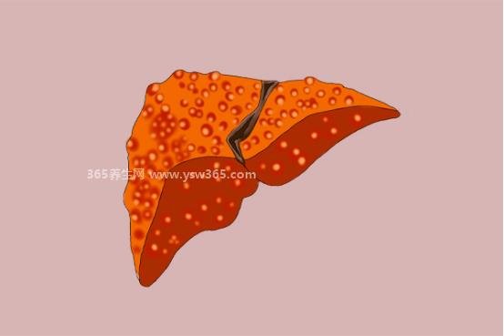 肝癌晚期能活多久一般,6-8个月左右(积极治疗会有很多生存机会)