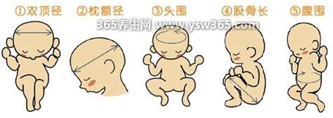 双顶径是什么意思,是指胎儿颅骨左右两侧最宽的距离