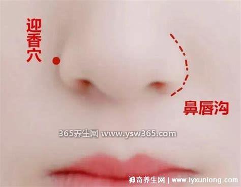鼻炎最简单的自愈方法,用生理盐水冲洗鼻腔长期坚持