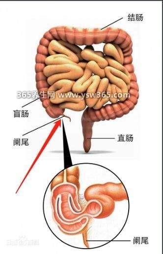 阑尾炎是哪个部位疼,急性阑尾炎会先有上腹痛然后是右下腹疼痛