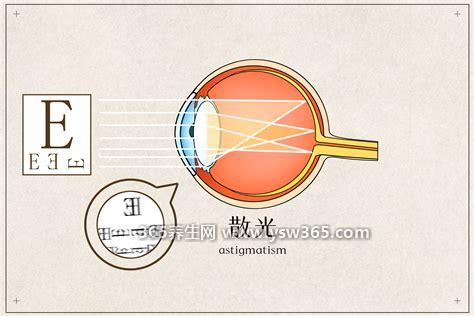 散光矫正一般多少钱可以矫正过来吗,一般只要几百元
