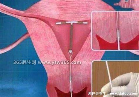 避孕针一针能管多久多少钱一针,时间为2至3个月(最贵500元)