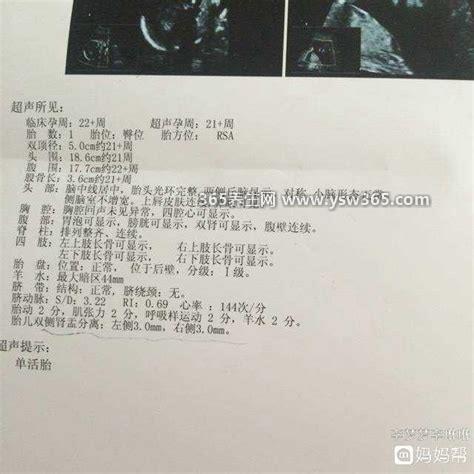100%生女儿的症状,爱吃辣/肚脐凸起/孕妈妈变美了可能是女儿