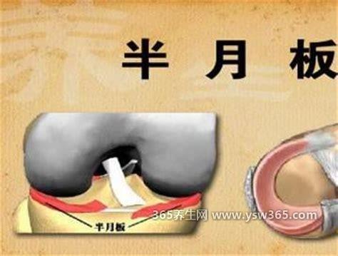 半月板是什么部位图片,是胫骨一端膝关节上的两块软骨