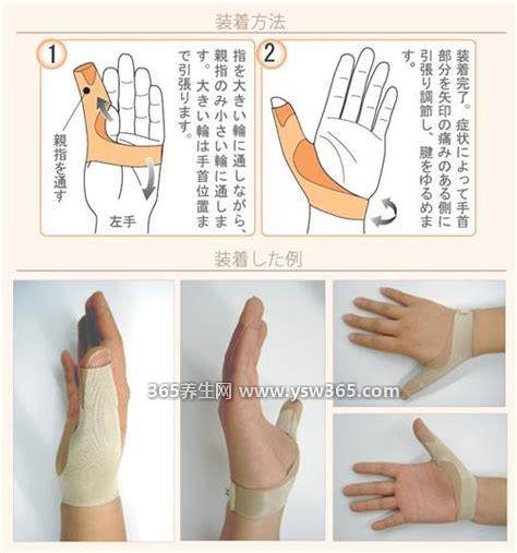 腱鞘炎最佳治疗方法大拇指关节疼痛,重症患者可选择手术治疗