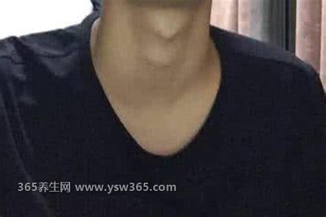 男生的喉结为什么不能碰,会让对方产生性冲动/会不舒服