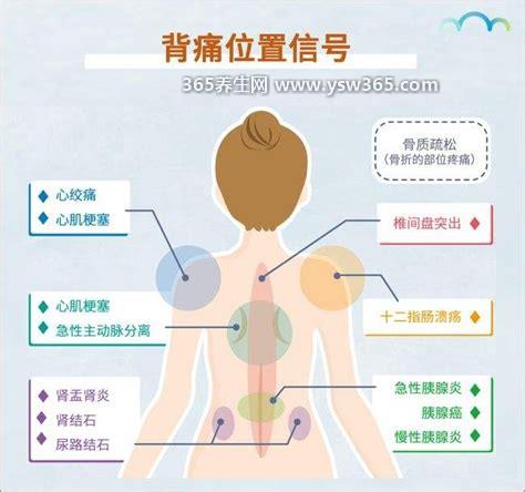 后背疼痛位置图详解图片,要小心是一些器官疾病引起的