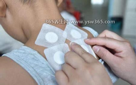 女人贴三伏贴有什么好处和禁忌小孩可以贴吗,可以缓解痛经