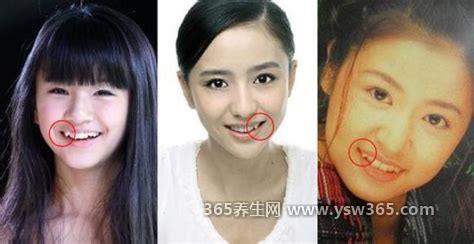 什么样的牙齿是虎牙长的标准样子图片,它们形状很尖/长在上牙