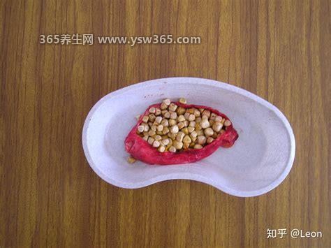 胆结石最怕三个蔬菜水果,韭菜/洋葱/辣椒会加重病情