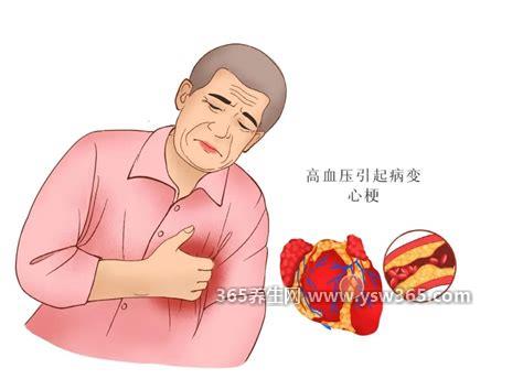 心梗的十大前兆,焦虑和失眠/心跳加剧/背痛/颈痛等