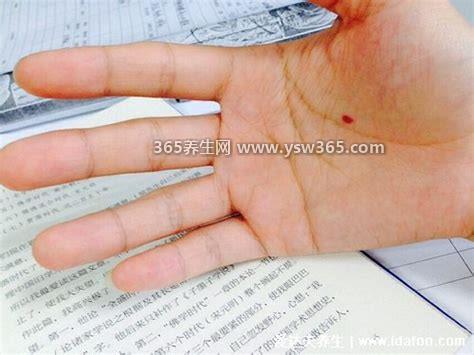 朱砂痣据说是上辈子爱你的人,象征着一段美好的爱情
