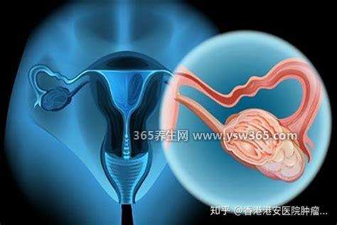 早期宫颈癌出血特点图片,会有少量鲜红的血流出