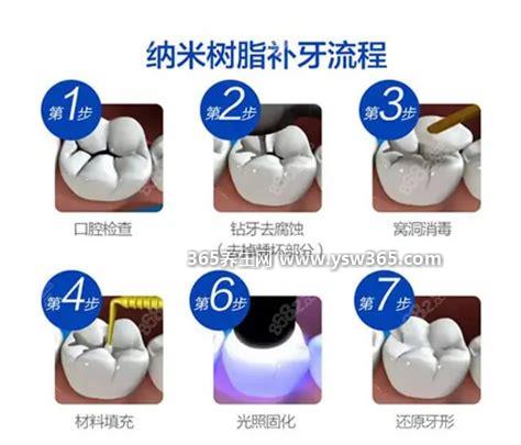 补牙多少钱一颗2022价格表-价格从100元到800元不等