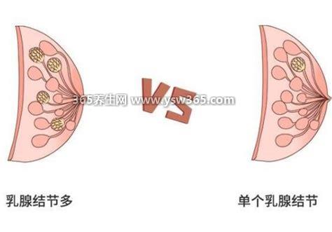 吃三个月逍遥丸治好乳腺结节,一般需要手术才能治好