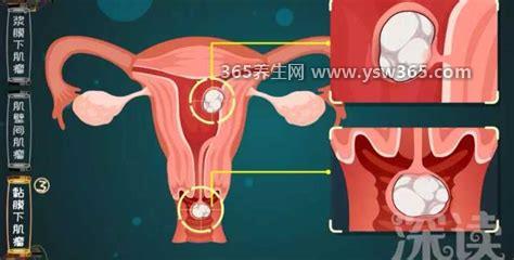 子宫肌瘤最怕4种食物,胡萝卜/五谷杂粮/莲藕/海带