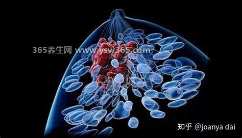 乳腺癌图片大全早期症状真人,发现乳腺肿块/皮肤异常一定要警惕