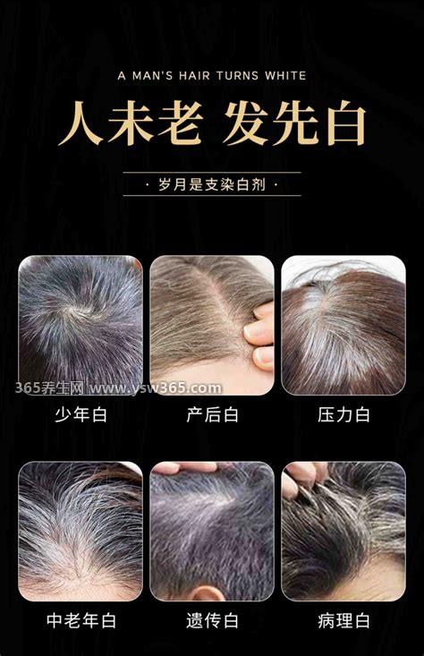 曲西达素可以让白发变黑吗多少钱,可以/价格168元左右