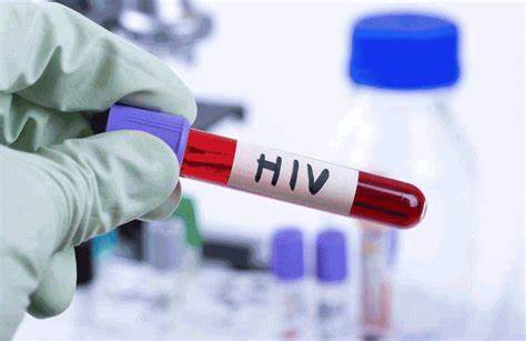 男女性hpv自查的10个方法-可以用hpv病毒检测自检盒