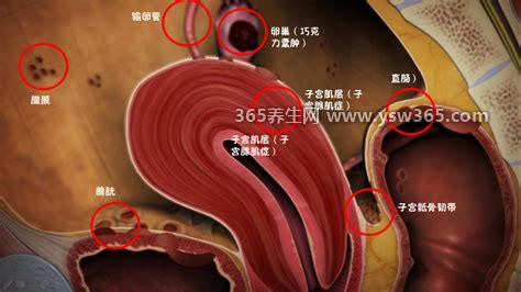 女性子宫内膜脱落真正图片,子宫内膜很像血块但不是血块