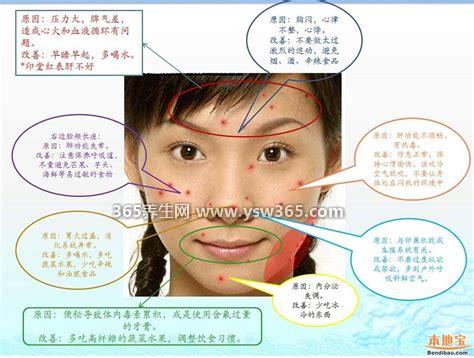 长痘痘的位置图解,眉毛上的粉刺很可能是心脏问题
