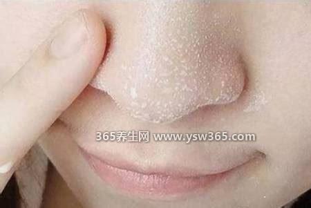 鼻子没有嗅觉怎么快速恢复,四种方法可能有效(闻咖啡等)