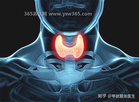 甲状腺结节怎么调理消除,良性和轻度结节可以通过饮食来治愈