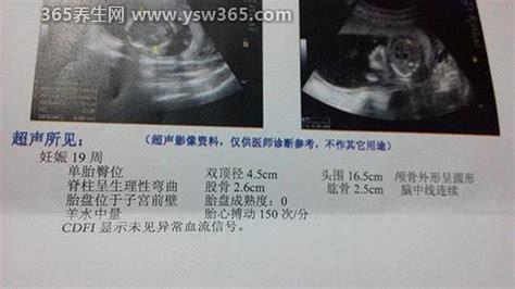 10秒测出怀男孩和女孩超准,男女晨尿酒精测试(不是100%准确)