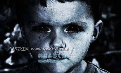 美国恐怖无脸人是怎么回事-患有奇怪的无脸症(先天性的)