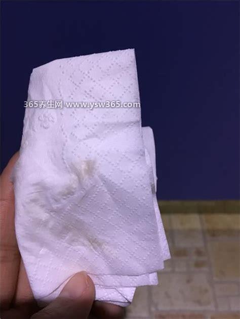 受精卵着床成功后出血图片,有少量鲜红色和淡粉色的血渍