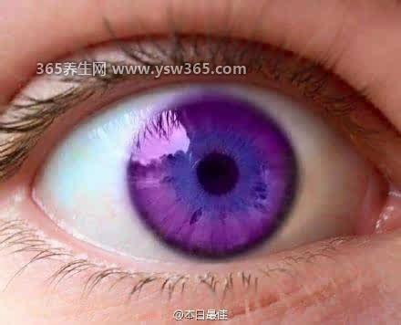 世界上有紫色的眼睛吗,有但很少(全世界只有600人)