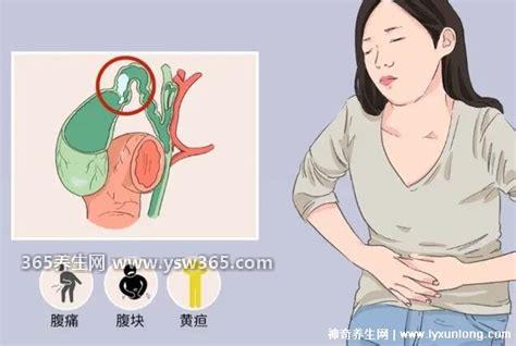 胆囊炎症状疼痛位置图,会引起右上腹疼痛但疼痛特征不同