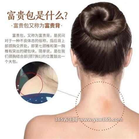 富贵包可以用什么方法快速消掉,以通过热敷来促进血液循环消除